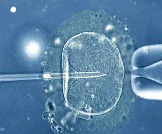四川助孕产子公司包成功多少钱|卵子的染色体异常，还可以做泰国试管婴儿吗