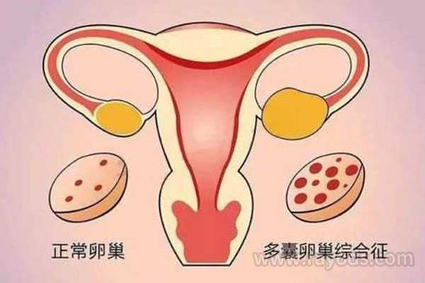 偃师市代孕服务电话,卵巢不好可以做试管吗_上海供卵试管婴儿中心