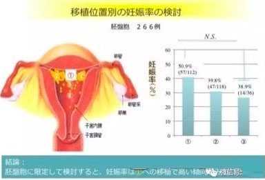 鼓楼区37岁供卵试管有风险吗_日本做试管婴儿花多少钱？| 附收费详情