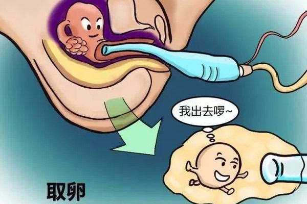贵州招聘试管婴儿代妈_贵州代妈来自农村_试管婴儿在取卵时会有哪些常见问题