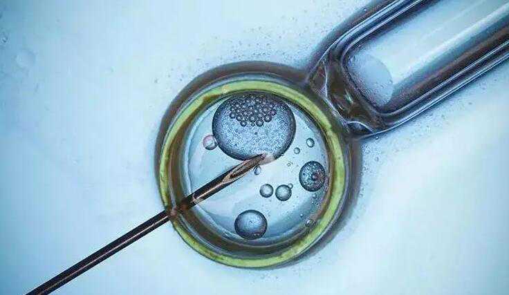 2021个人急找代孕女人一名_代孕必须用自己的卵_三代试管具体流程和时间安排表