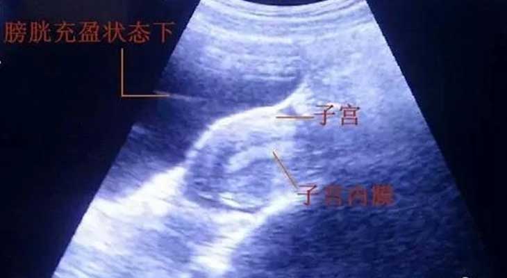 沧　县找个代妈需要多少费用_沧　县职业孕妈妈_营口姐妹为啥试管婴儿胚胎移